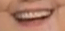 hillary teeth 2